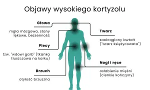 Nadmiar kortyzolu objawy: mgła mózgowa, lęki, bezsenność, garb, otyłość brzuszna, księżycowata twarz, osłabienie mięśni.