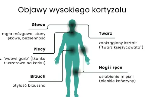 Nadmiar kortyzolu objawy: mgła mózgowa, lęki, bezsenność, garb, otyłość brzuszna, księżycowata twarz, osłabienie mięśni.