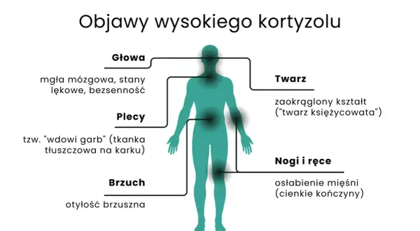 Nadmiar kortyzolu objawy: mgła mózgowa, lęki, bezsenność, garb, otyłość brzuszna, księżycowata twarz, osłabienie mięśni.