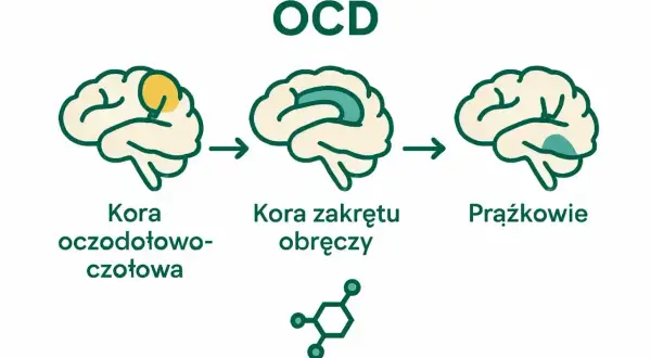 Schemat mózgu ilustrujący OCD. Pokazuje zmiany w korze oczodołowo-czołowej, korze zakrętu obręczy i jądrach podstawy, które mogą prowadzić do zachowań kompulsywnych.