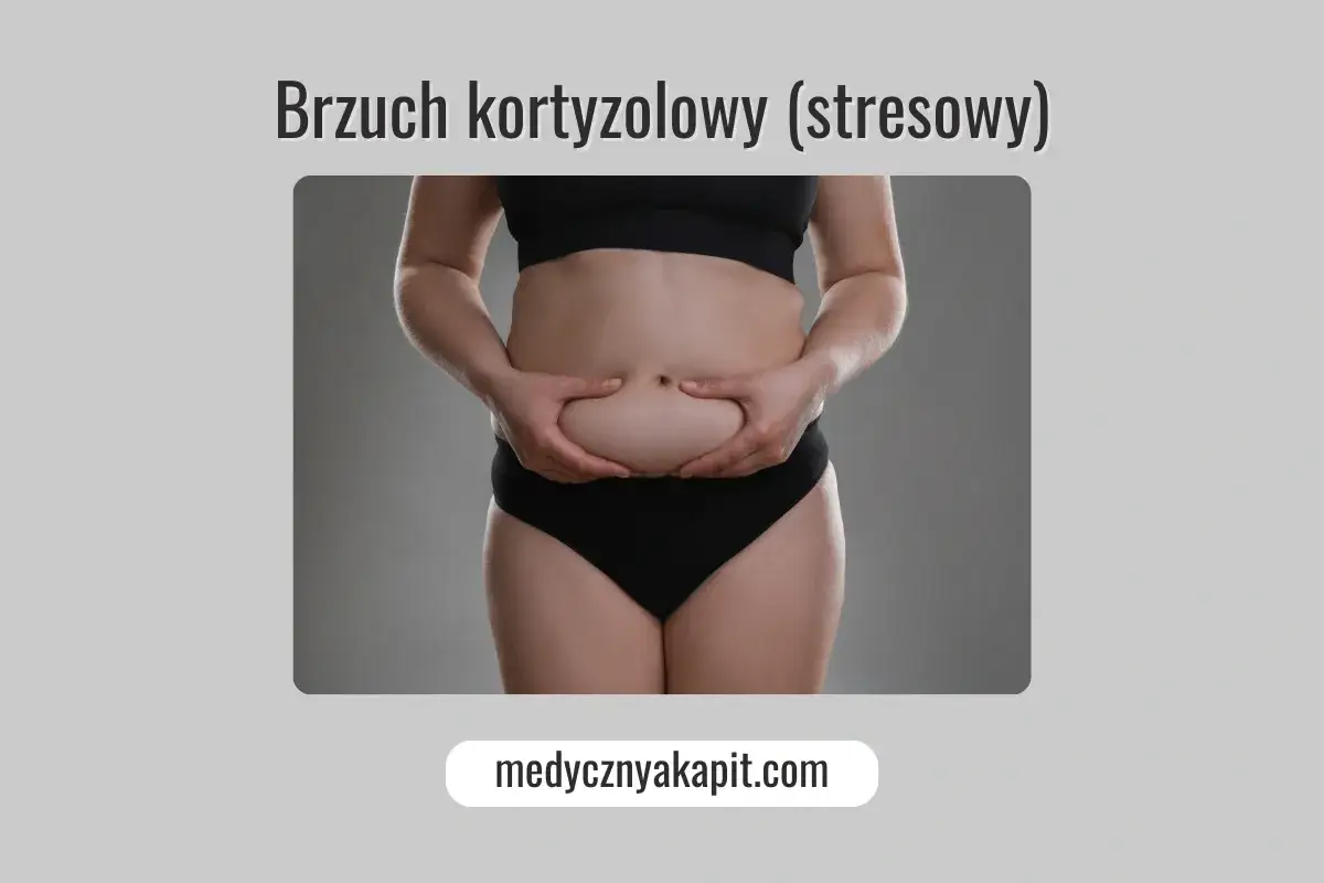 Kobieta chwyta się za brzuch, który może być objawem nadmiaru kortyzolu.