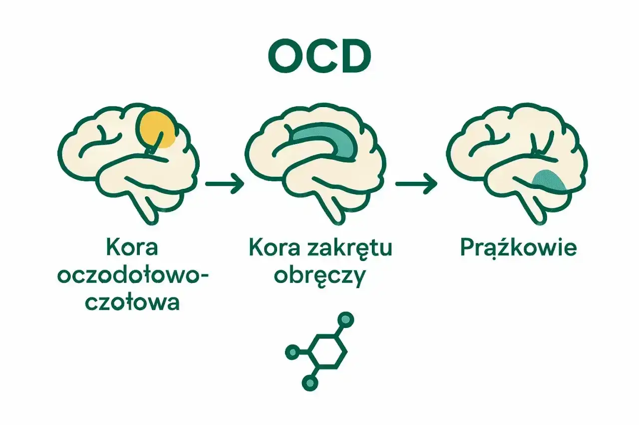 Schemat mózgu z zaznaczonymi obszarami, ilustrujący zmiany w OCD. Kompulsywny charakter zaburzenia wiąże się z aktywnością kory oczodołowo-czołowej, kory zakrętu obręczy i prążkowia.
